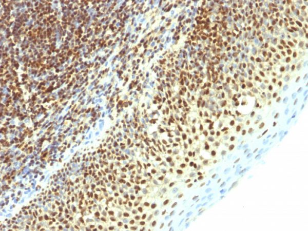 Formalin-fixed, paraffin-embedded human Tonsil stained with SUMO-2 Mouse Monoclonal Antibody (SPM261).