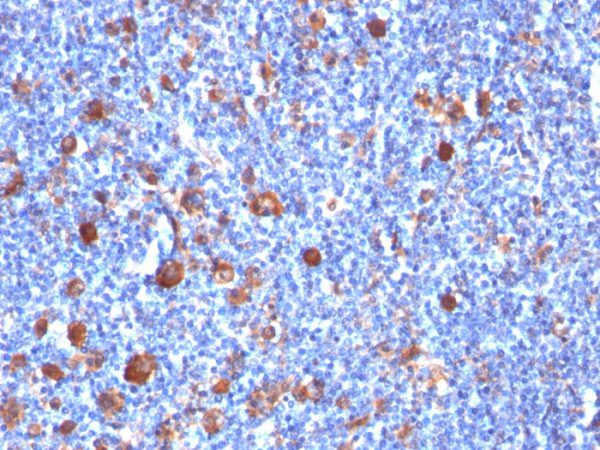 Fascin-1 (Reed-Sternberg Cell Marker) Antibody