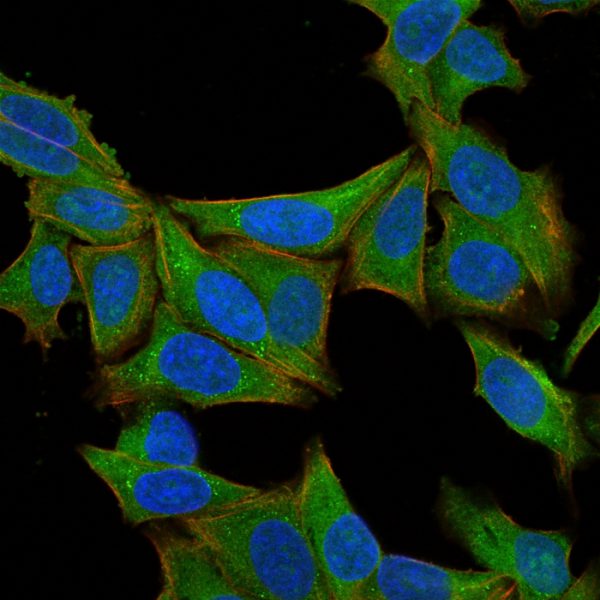 Fascin-1 (Reed-Sternberg Cell Marker) Antibody - Image 5