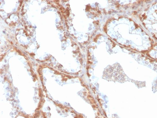 Formalin-fixed, paraffin-embedded human prostate stained with Superoxide Dismutase 1 Mouse Monoclonal Antibody (SOD1/4331).