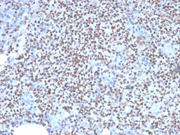 Formalin-fixed, paraffin-embedded human Lymph Node stained with PU.1-Monospecific Mouse Monoclonal Antibody (PU1/2146).