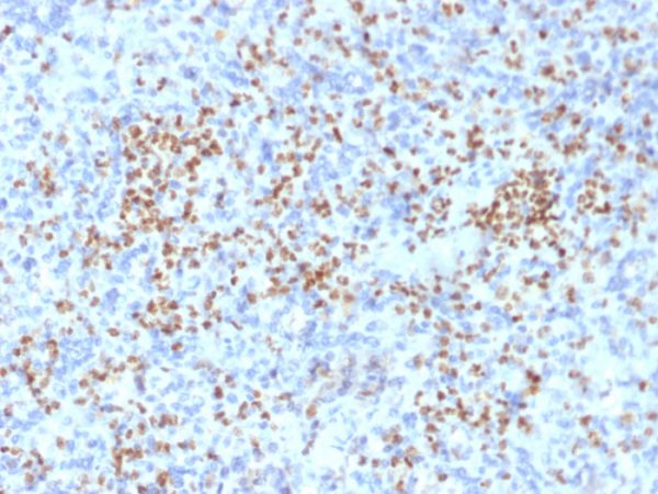 Formalin-fixed, paraffin-embedded human Spleen stained with PU.1-Monospecific Mouse Monoclonal Antibody (PU1/2146).