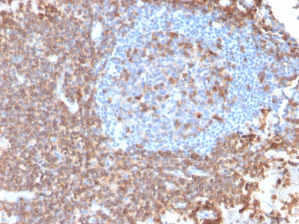 Formalin-fixed, paraffin-embedded human Lymph Node stained with CD43 Mouse Recombinant Monoclonal Antibody (rSPN/839).