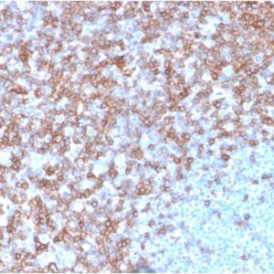 Formalin-fixed, paraffin-embedded human spleen stained with CD43 Mouse Monoclonal Antibody (SPN/3388).