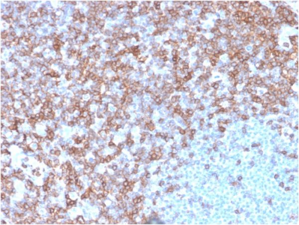 Formalin-fixed, paraffin-embedded human spleen stained with CD43 Mouse Monoclonal Antibody (SPN/3388).