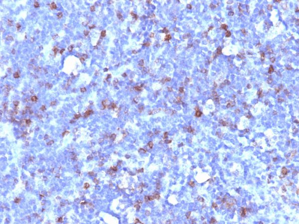 CD43 (T-Cell Marker) Antibody