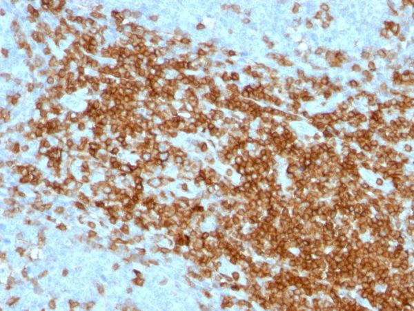 CD43 (T-Cell Marker) Antibody - Image 2