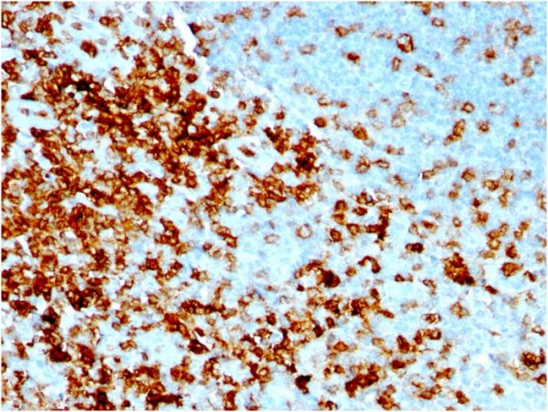 Formalin-fixed, paraffin-embedded human Tonsil stained with CD43 Mouse Recombinant Monoclonal Antibody (rSPN/1094).