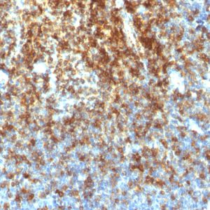 Formalin-fixed, paraffin-embedded human Tonsil stained with CD43 Rabbit Recombinant Monoclonal Antibody (SPN/1766R).