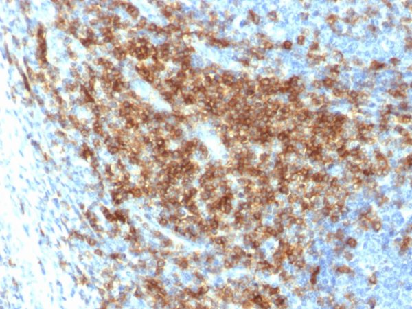 Recombinant CD43 (T-Cell Marker) Antibody