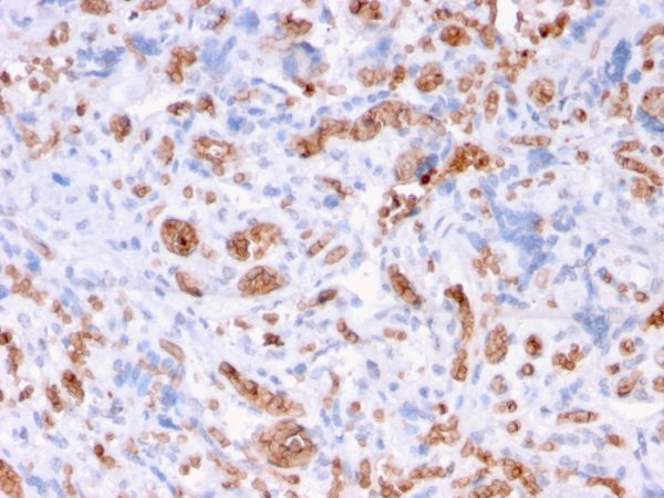 Recombinant Spectrin Alpha 1 (Erythrocyte Marker) Antibody - Image 5