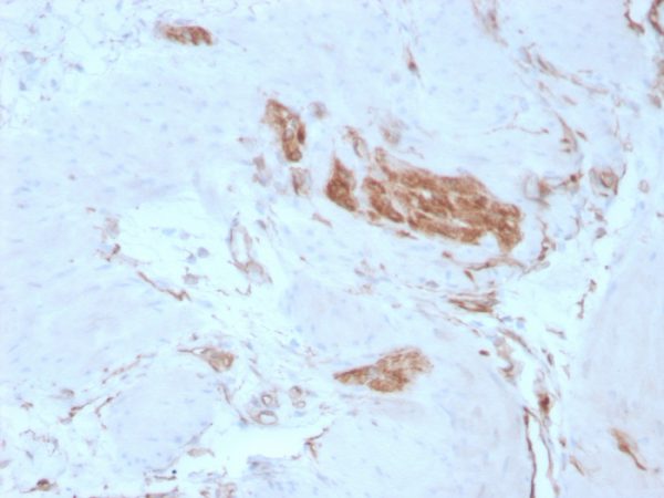 Formalin-fixed, paraffin-embedded human Tonsil stained with Fodrin Mouse Monoclonal Antibody (SPTAN1/3351).