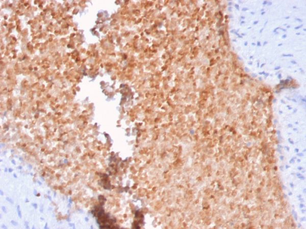 Formalin-fixed, paraffin-embedded human lung stained with Fodrin Mouse Monoclonal Antibody (SPTAN1/3352).