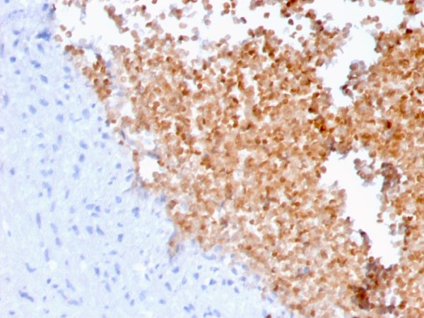 Formalin-fixed, paraffin-embedded human lung stained with Fodrin Mouse Monoclonal Antibody (SPTAN1/3352).