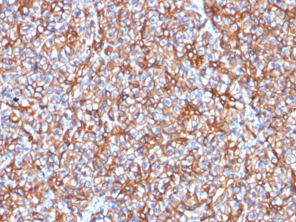 Formalin-fixed, paraffin-embedded human pancreas stained with Spectrin beta III Mouse Monoclonal Antibody (SPTBN2/1778).