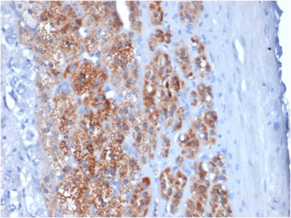 StAR (Steroidogenic Acute Regulator) (Leydig Cell Marker) Antibody