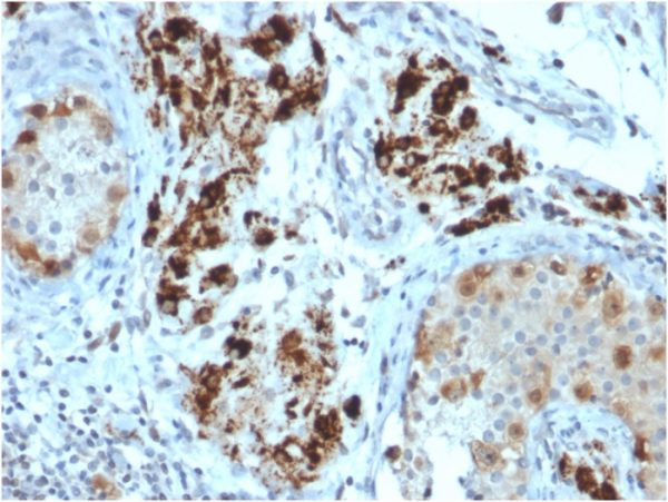 StAR (Steroidogenic Acute Regulator) (Leydig Cell Marker) Antibody - Image 3