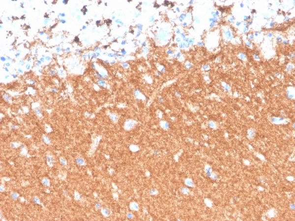 Formalin-fixed, paraffin-embedded human brain stained with Synaptophysin Recombinant Rabbit Monoclonal Antibody (SYP/4503R).