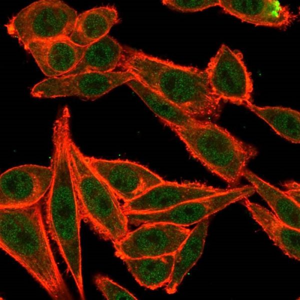 TRBP2 / TARBP2 Antibody - Image 2