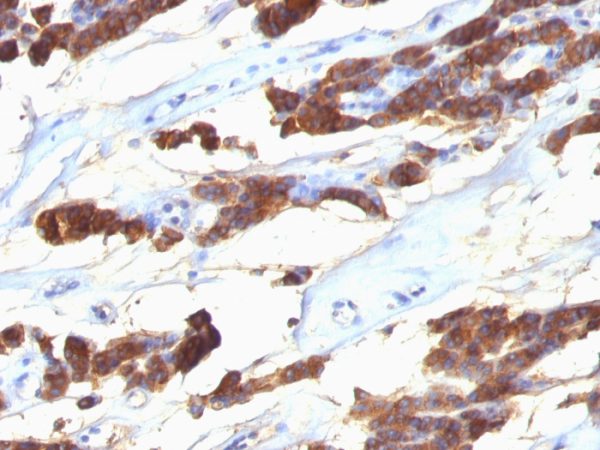 Thyroglobulin (Thyroidal Cell Marker) Antibody