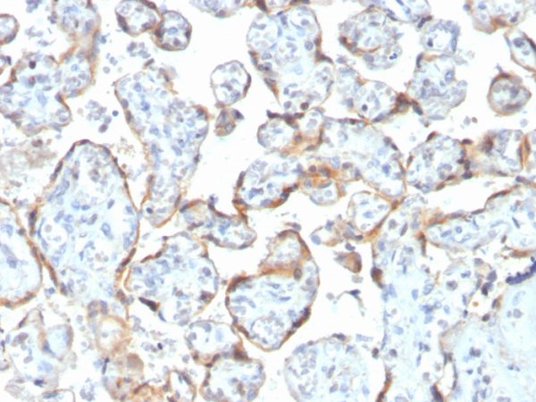 Recombinant TIMP2 (Tissue Inhibitor of Metalloproteinase 2) Antibody