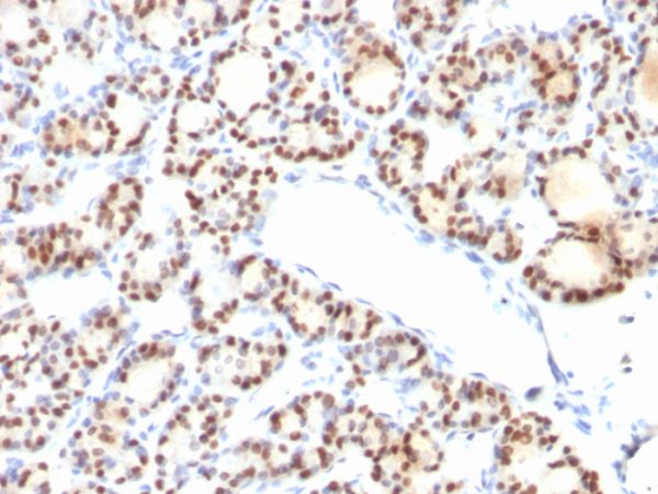 TTF-1 / NKX2.1 (Thyroid & Lung Epithelial Marker) Antibody - Image 2