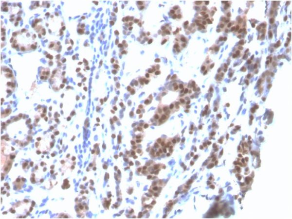 Recombinant TTF-1 / NKX2.1 (Thyroid & Lung Epithelial Marker) Antibody - Image 2