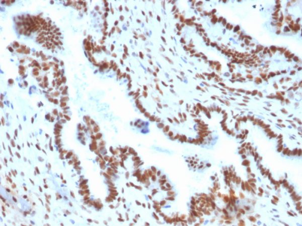 TLE1 (Synovial Sarcoma Marker) Antibody