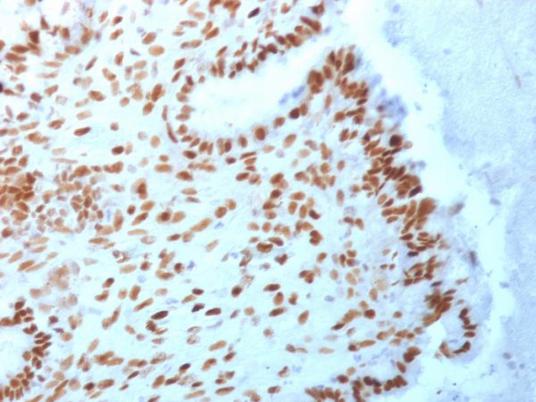 TLE1 (Synovial Sarcoma Marker) Antibody