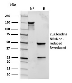 SDS-PAGE Analysis of Purified CD282 Recombinant Mouse Monoclonal antibody (rTLR2/221). Confirmation of Purity and Integrity of Antibody.