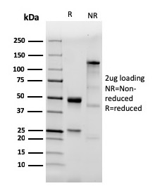 SDS-PAGE Analysis of Purified CD282 Recombinant Rabbit Monoclonal antibody (TLR2/3894R). Confirmation of Purity and Integrity of Antibody.
