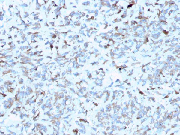 Formalin-fixed, paraffin-embedded human Kidney stained with C1QA Mouse Monoclonal Antibody (C1QA/2952).