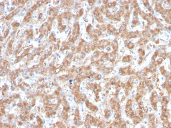 Formalin-fixed, paraffin-embedded human Liver stained with C1QA Mouse Monoclonal Antibody (C1QA/2952).