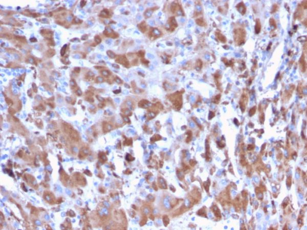 Formalin-fixed, paraffin-embedded human Liver stained with C1QA Mouse Monoclonal Antibody (C1QA/2953).