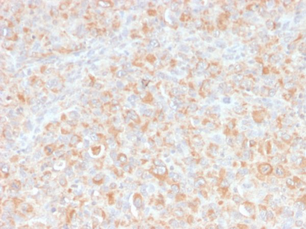 TNF-alpha (Tumor Necrosis Factor alpha) Antibody