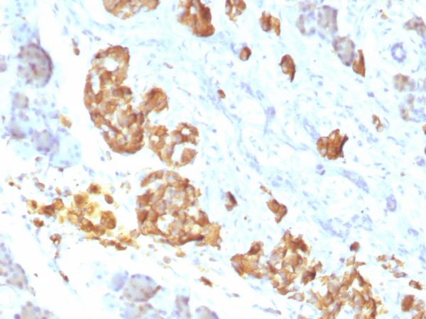 Formalin-fixed, paraffin-embedded human pancreas stained with TNF alpha Mouse Monoclonal Antibody (P/T2).