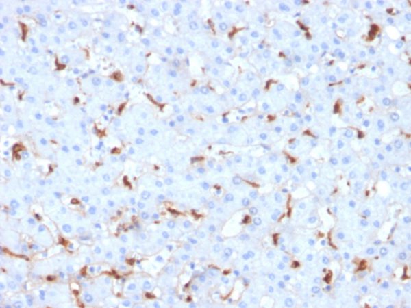 C1QB / Complement C1q B-Chain Antibody