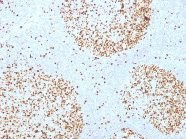 Formalin-fixed, paraffin-embedded human Tonsil stained with Topoisomerase II alpha Monoclonal Antibody (TOP2A/1361).