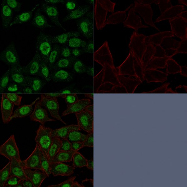 Confocal Immunofluorescence image of HeLa cells using Topo II alpha, Monoclonal Antibody (TOP2A/1361). Green (CF488) and Phalloidin (Red) is used to label the nuclei.