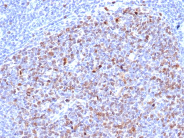 Formalin-fixed, paraffin-embedded human tonsil stained with Topo II alpha Recombinant Mouse Monoclonal Antibody (rTOP2A/6629).