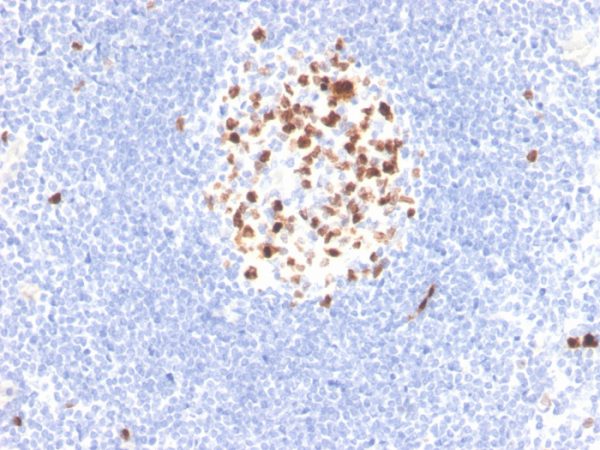 Formalin-fixed, paraffin-embedded human lymph node stained with Topo II alpha Recombinant Mouse Monoclonal Antibody (rTOP2A/6629).