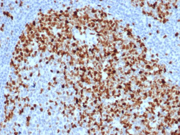 Formalin-fixed, paraffin-embedded human tonsil stained with Topo IIa Recombinant Rabbit Monoclonal Antibody (TOP2A/6570R).