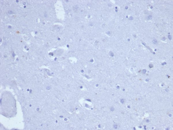 IHC analysis of formalin-fixed, paraffin-embedded human brain. Negative tissue control using TOP2A/6570R at 2ug/ml in PBS for 30min RT. HIER: Tris/EDTA, pH9.0, 45min. 2 °: HRP-polymer, 30min. DAB, 5min.