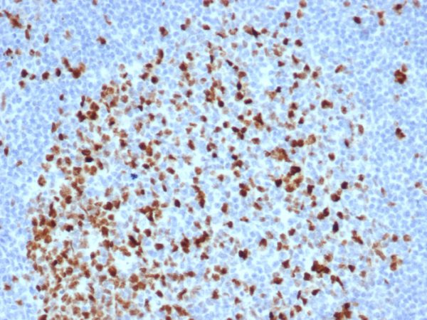 Formalin-fixed, paraffin-embedded human lymph node stained with Topo IIa Recombinant Rabbit Monoclonal Antibody (TOP2A/6570R).