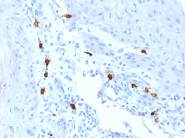 Formalin-fixed, paraffin-embedded human skin stained with Tryptase Mouse Monoclonal Antibody (TPSAB1/1963). HIER: Tris/EDTA, pH9.0, 45min. 2°C: HRP-polymer, 30min. DAB, 5min.