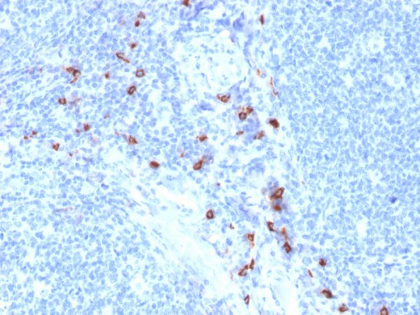 Formalin-fixed, paraffin-embedded human tonsil stained with Tryptase Mouse Monoclonal Antibody (TPSAB1/1963). HIER: Tris/EDTA, pH9.0, 45min. 2°C: HRP-polymer, 30min. DAB, 5min.