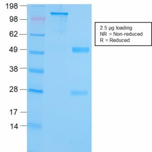 SDS-PAGE Analysis of Purified GRP94 Recombinant Rabbit Monoclonal (HSP90B1/3168R). Confirmation of Purity and Integrity of Antibody.