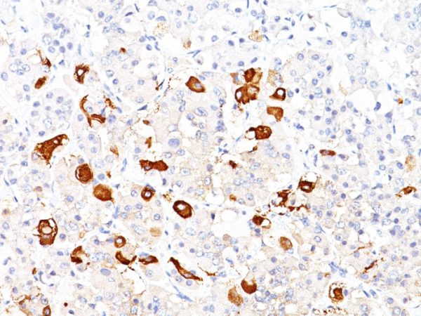 Formalin-fixed, paraffin-embedded human pituitary stained with TSH beta Mouse Monoclonal Antibody (TSHb/1317).