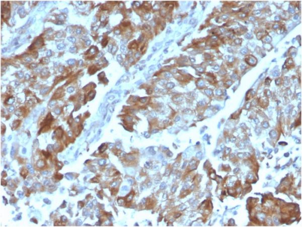 OX40 / CD134/ TNFRSF4 (Immuno-Oncology Target) Antibody