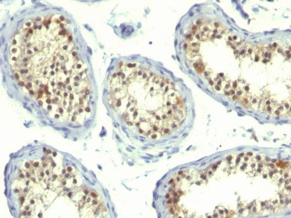 Thymidylate Synthase (5-FU Resistance Marker) Antibody